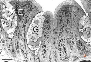 normal mucosa - duodenum - enterocytes and goblet cells
